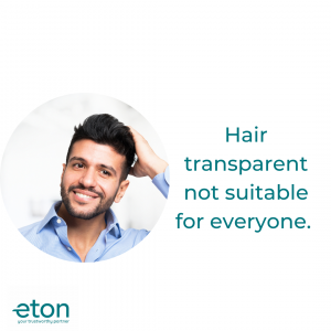 A short guide to hair transplantation