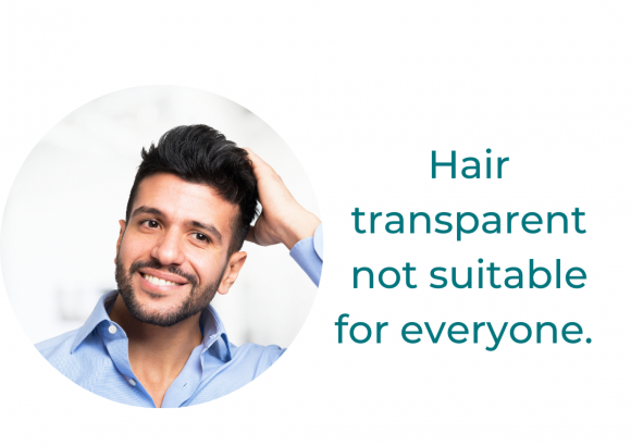 A short guide to hair transplantation