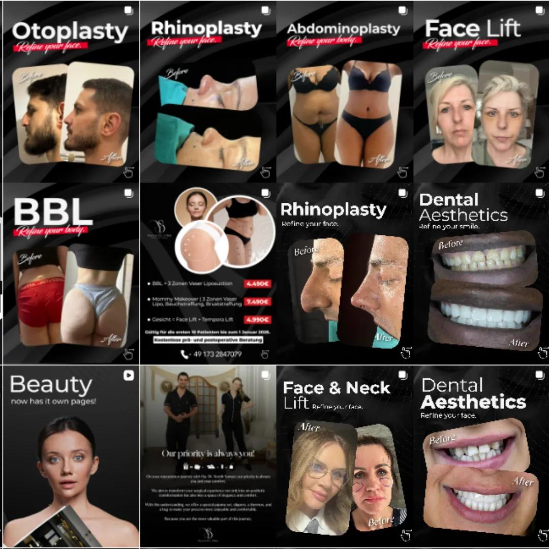 Dr Semih Gokkaya plastic surgery Instagram highlight 4