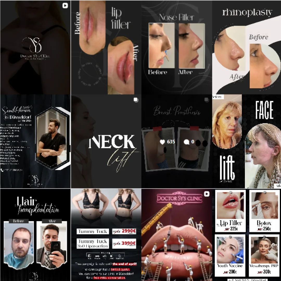 Dr Semih Gokkaya plastic surgery Instagram highlight 6