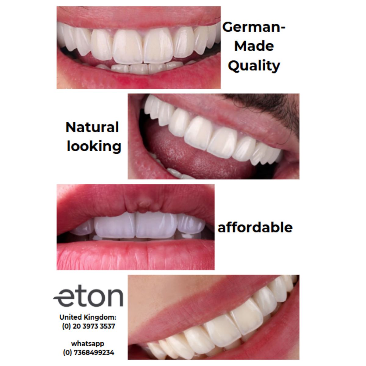 UK Patients